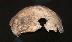 Una fotografia del presunto cranio di Hitler
