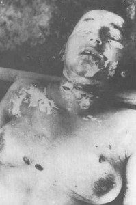 Le donne serbe venivano sistematicamente violentate e torturate dopodiché venivano loro tolti gli occhi e infine uccise